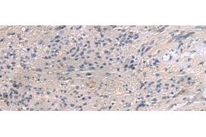 Immunohistochemistry of paraffin-embedded Human brain tissue using PAIP1 Polyclonal Antibody at dilution of 1:80(x200) (PAIP1 antibody)