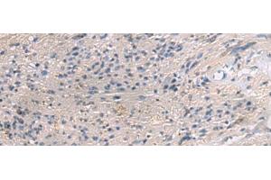 Immunohistochemistry of paraffin-embedded Human brain tissue using PAIP1 Polyclonal Antibody at dilution of 1:80(x200)