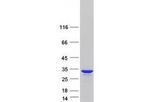 Validation with Western Blot (HSD17B14 Protein (Myc-DYKDDDDK Tag))