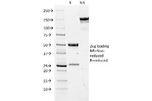 SDS-PAGE Analysis Purified CEA Mouse Monoclonal Antibody (COL-1). (CEACAM5 antibody)