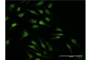 Immunofluorescence of monoclonal antibody to MAP2K2 on HeLa cell. (MEK2 antibody  (AA 1-360))