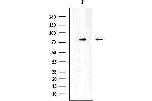 Western blot analysis of lysates from HepG2 cells(LPS 4h treatment), using GIT2 Mouse Monoclonal Antibody at 1/1000 dilution.