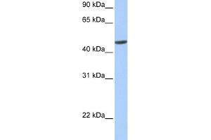 WB Suggested Anti-hCG_20426 Antibody Titration:  0. (ANKRD65 antibody  (N-Term))