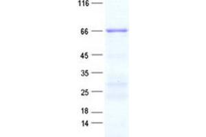 Validation with Western Blot (CDK5RAP1 Protein (His tag))