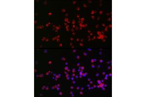 Immunofluorescence analysis of Neuro-2a cells using NOGO Receptor 1 (RTN4R) Rabbit pAb (ABIN6129725, ABIN6147296, ABIN6147297 and ABIN6221547) at dilution of 1:25 (40x lens). (RTN4R antibody  (AA 244-473))