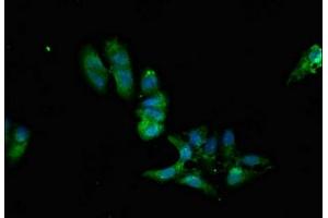 Immunofluorescent analysis of Hela cells using ABIN7169242 at dilution of 1:100 and Alexa Fluor 488-congugated AffiniPure Goat Anti-Rabbit IgG(H+L) (PPP2R2A antibody  (Regulatory Subunit B))