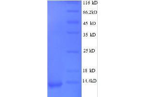 Chemokine (C-X-C Motif) Ligand 1 (Melanoma Growth Stimulating Activity, Alpha) (CXCL1) (AA 35-107), (full length) protein (His tag) (CXCL1 Protein (AA 35-107, full length) (His tag))
