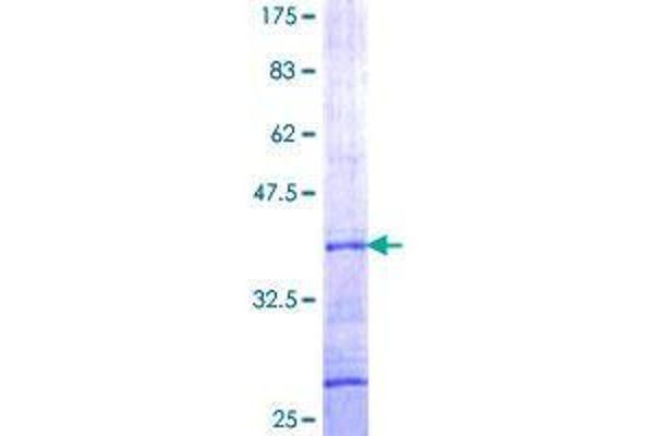 GGA3 Protein (AA 246-345) (GST tag)