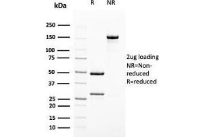 SDS-PAGE Analysis Purified Uroplakin 1B Mouse Monoclonal Antibody (UPK1B/3102). (Uroplakin 1B antibody  (AA 109-229))
