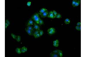 Immunofluorescence staining of HepG2 cells with ABIN7142343 at 1:133, counter-stained with DAPI. (ERI1 antibody  (AA 2-66))