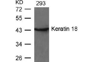 Image no. 2 for anti-Keratin 18 (KRT18) (AA 31-35) antibody (ABIN197580) (Cytokeratin 18 antibody  (AA 31-35))