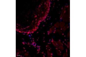 Immunofluorescence of paraffin embedded mouse esophagus using USP34 (ABIN7076115) at dilution of 1:700 (400x lens) (USP34 antibody)