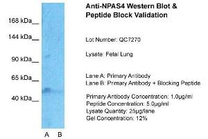 Host:  Rabbit  Target Name:  NPAS4  Sample Type:  Fetal Lung  Lane A:  Primary Antibody  Lane B:  Primary Antibody + Blocking Peptide  Primary Antibody Concentration:  1ug/ml  Peptide Concentration:  5ug/ml  Lysate Quantity:  25ug/lane/Lane  Gel Concentration:  0. (NPAS4 antibody  (Middle Region))