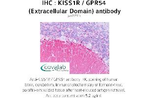 Image no. 2 for anti-KISS1 Receptor (KISS1R) (2nd Extracellular Domain) antibody (ABIN1736236) (KISS1R antibody  (2nd Extracellular Domain))