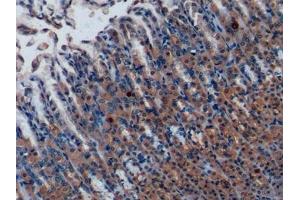 Detection of MCP1 in Rat Stomach Tissue using Polyclonal Antibody to Monocyte Chemotactic Protein 1 (MCP1) (CCL2 antibody  (AA 24-148))