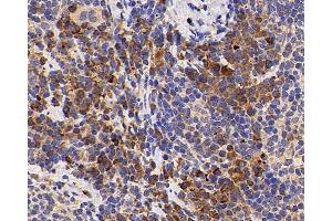Immunohistochemistry analysis of paraffin-embedded mouse inflammatory spleen using IL2 Polyclonal Antibody at dilution of 1:500. (IL-2 antibody)