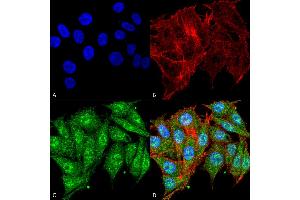 Immunocytochemistry/Immunofluorescence analysis using Rabbit Anti-IGF-1 Polyclonal Antibody .