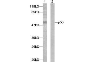 Western blot analysis of extracts from 293 cells treated with (p53 antibody)