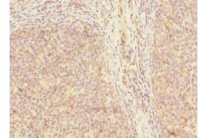 Immunohistochemistry of paraffin-embedded human tonsil tissue using ABIN7169499 at dilution of 1:100 (SH3D19 antibody  (AA 468-767))