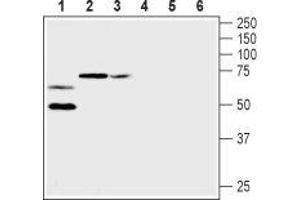 Western blot analysis of rat heart membranes (lanes 1 and 4), mouse brain membranes (lanes 2 and 5) and rat brain membranes (lanes 3 and 6): - 1-3. (KCNA2 antibody  (Extracellular))