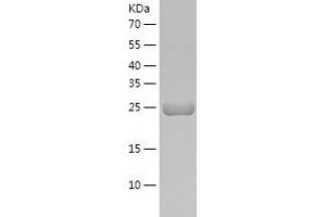 Western Blotting (WB) image for Mast Cell Tryptase (AA 35-267) protein (His tag) (ABIN7286949) (Mast Cell Tryptase Protein (AA 35-267) (His tag))