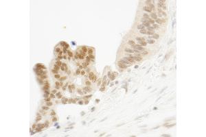 Immunohistochemistry (IHC) image for anti-E74-Like Factor 1 (Ets Domain Transcription Factor) (ELF1) (AA 569-619) antibody (ABIN7448550)
