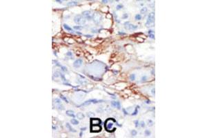 Immunohistochemistry (IHC) image for anti-Platelet-Derived Growth Factor Receptor-Like (PDGFRL) antibody (ABIN3003406)