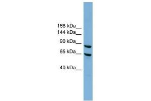 EXOC6 antibody used at 1 ug/ml to detect target protein. (EXOC6 antibody  (N-Term))