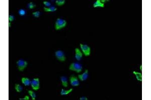Immunofluorescence staining of Hela cells with ABIN7173872 at 1:100, counter-stained with DAPI. (TNFRSF1A antibody  (AA 249-455))