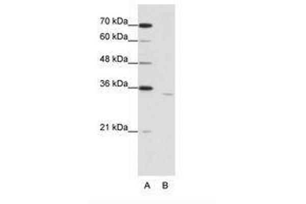 CPEB2 Antikörper  (AA 473-522)