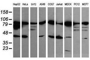Image no. 1 for anti-Catenin (Cadherin-Associated Protein), beta 1, 88kDa (CTNNB1) antibody (ABIN1496898) (CTNNB1 antibody)