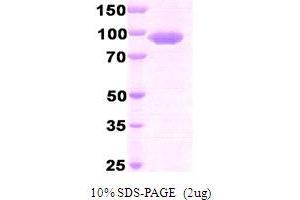 SDS-PAGE (SDS) image for Dipeptidyl-Peptidase 4 (DPP4) (AA 39-766) protein (His tag) (ABIN666712)