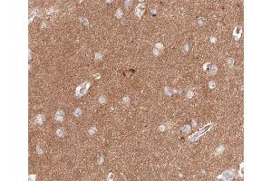 ABIN6267646 at 1/200 staining human brain tissue sections by IHC-P.