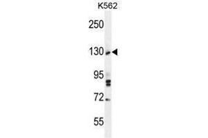 TTBK2 Antibody (N-term) western blot analysis in K562 cell line lysates (35 µg/lane). (TTBK2 antibody  (N-Term))