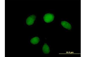 Immunofluorescence of purified MaxPab antibody to HUS1 on HeLa cell.