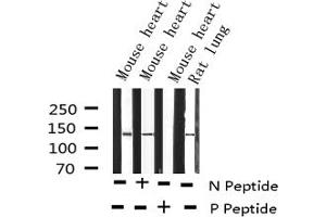 Western blot analysis of Phospho-Abl (Tyr412) expression in various lysates