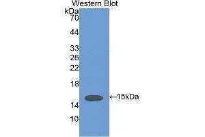 Western Blotting (WB) image for anti-Vinculin (VCL) (AA 1020-1134) antibody (ABIN1175095)