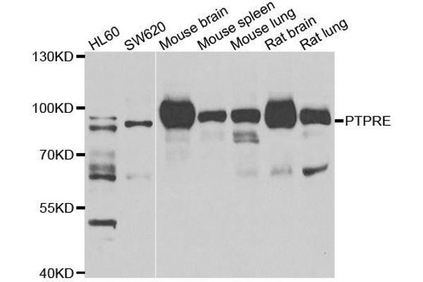 PTPRE antibody  (AA 20-200)