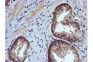 Image no. 2 for anti-Histidyl-tRNA Synthetase 2, Mitochondrial (Putative) (HARS2) antibody (ABIN1498584) (HARS2 antibody)