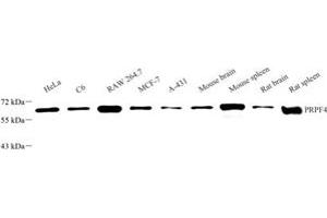 Western blot analysis of PRPF4 (ABIN7075312) at dilution of 1: 500 (PRPF4 antibody)