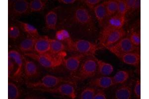 Immunofluorescence staining of methanol-fixed MCF cells using VEGFR2(Phospho-Tyr1175) Antibody. (VEGFR2/CD309 antibody  (pTyr1175))