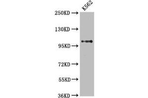 Western Blot Positive WB detected in: K562 whole cell lysate All lanes: DGCR8 antibody at 2. (Recombinant DGCR8 antibody)