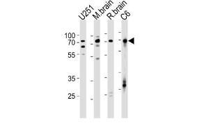Western Blotting (WB) image for anti-Far Upstream Element (FUSE) Binding Protein 1 (FUBP1) antibody (ABIN2997751)