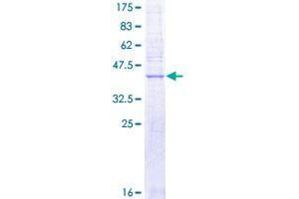 SLC50A1 Protein (AA 1-167) (GST tag)