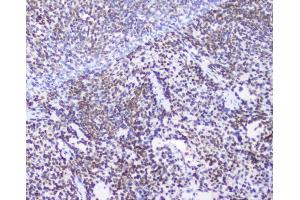 IHC analysis of AHR using anti-AHR antibody (ABIN6719265). (Aryl Hydrocarbon Receptor antibody)