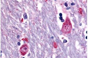 Human Brain, Caudate (formalin-fixed, paraffin-embedded) stained with CHRM3 antibody ABIN213499 at 10 ug/ml followed by biotinylated goat anti-rabbit IgG secondary antibody ABIN481713, alkaline phosphatase-streptavidin and chromogen. (CHRM3 antibody  (Cytoplasmic Domain))
