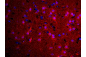 Formalin-fixed and paraffin embedded rat brain labeled with Rabbit Anti-TGM2 Polyclonal Antibody, Unconjugated used at 1:200 dilution for 40 minutes at 37°C (Transglutaminase 2 antibody  (AA 551-650))