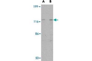 Western blot analysis of SLITRK3 in SK-N-SH cell lysate with SLITRK3 polyclonal antibody  at (A) 0. (SLITRK3 antibody  (C-Term))
