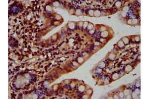 IHC image of ABIN7157562 diluted at 1:400 and staining in paraffin-embedded human small intestine tissue performed on a Leica BondTM system. (KTN1 antibody  (AA 978-1116))