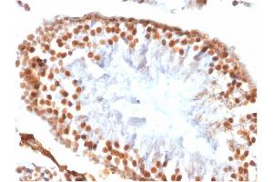 Formalin-fixed, paraffin-embedded Rat Testis stained with Wilm's Tumor Rabbit Recombinant Monoclonal Antibody (WT1/1434R).